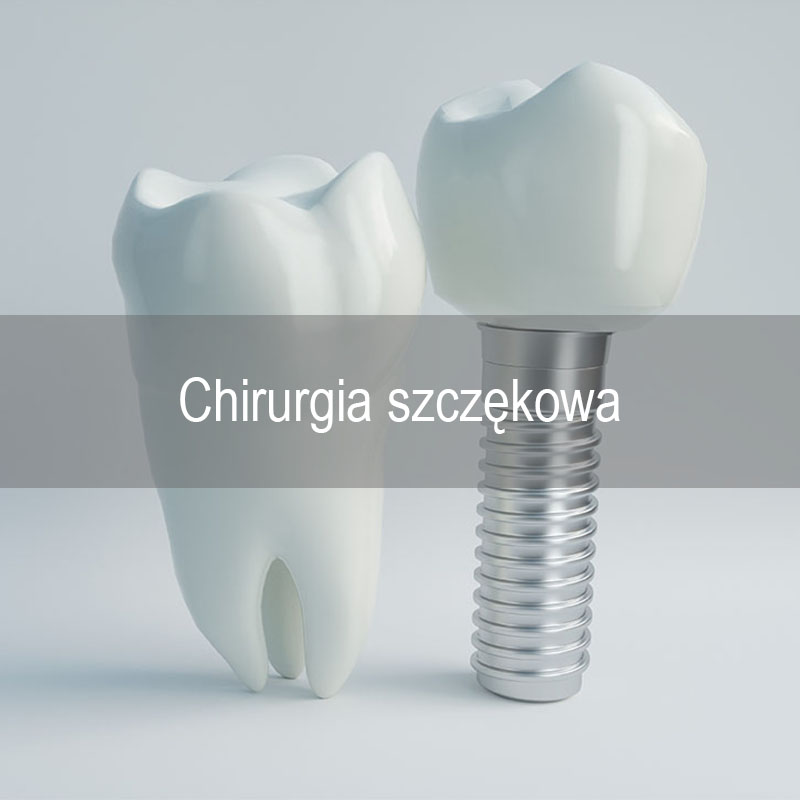 Chirurgia szczękowa Gdańsk - infografika oferty Neodentica