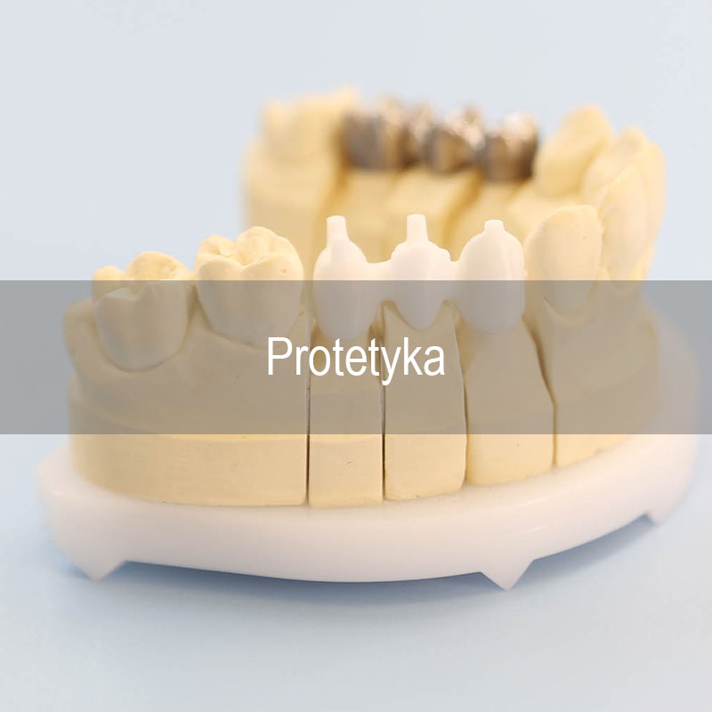 Protetyka stomatologiczna Gdańsk - infografika oferty Neodentica